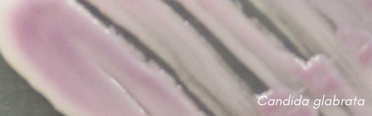 Candida glabrata