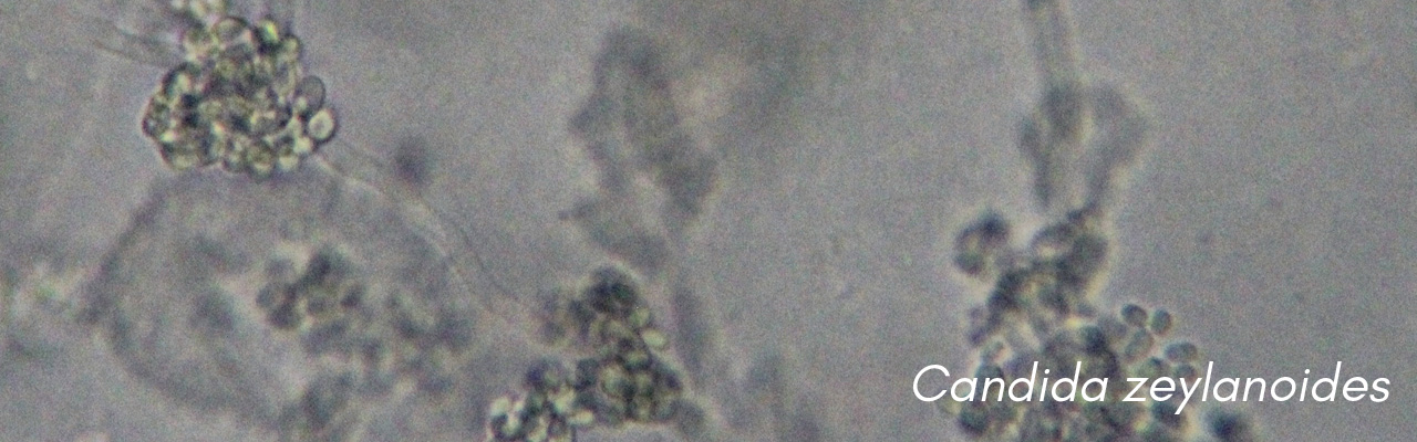Candida zeylanoides