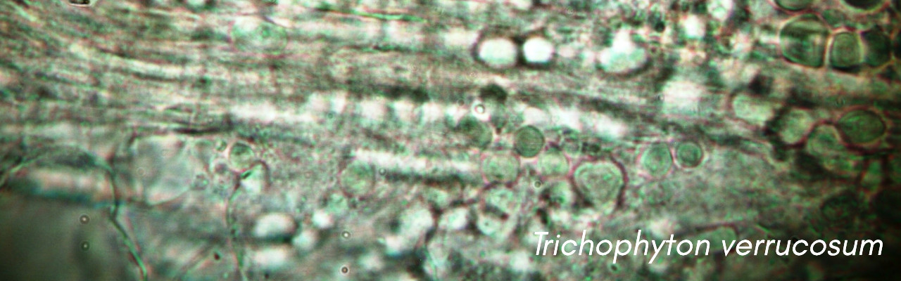 Trichophyton verrucosum